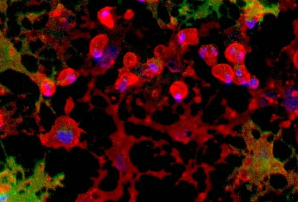 koma-oligodendrocyte_like_cells.png