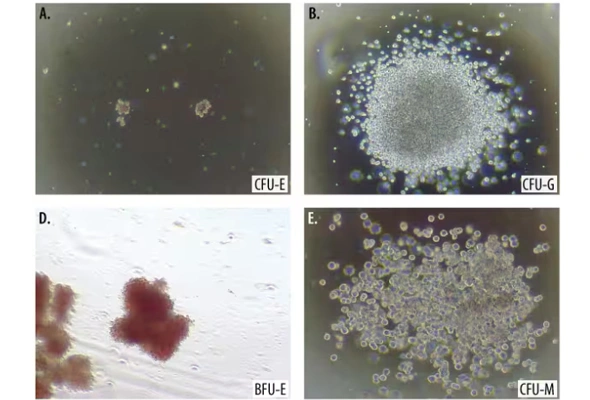조혈모세포 CFC 분석을 위한 Methylcellulose media 이미지
