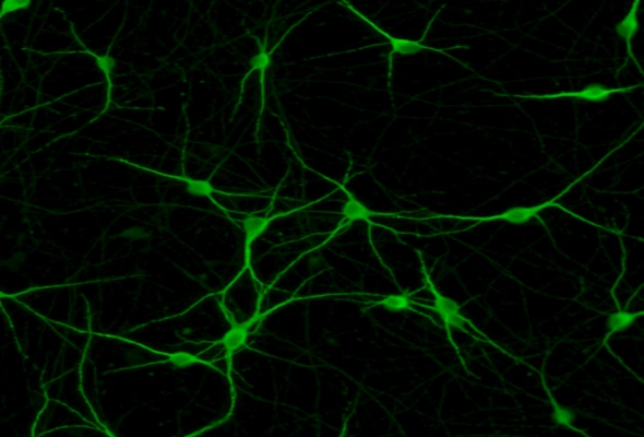 운동뉴런 질환모델 | ioMotor Neurons diseased model 이미지