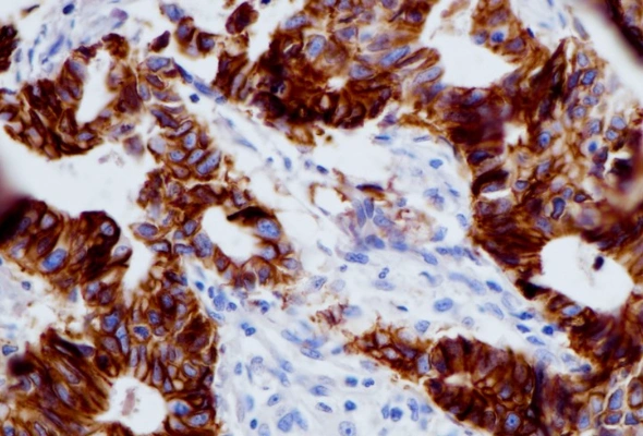 Cadherin-17 Antibody & Protein 이미지