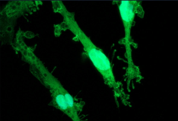GFP ioMicroglia 이미지