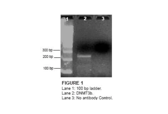 [Novus] 크로마틴 분리 ChIP Assay Kit 이미지