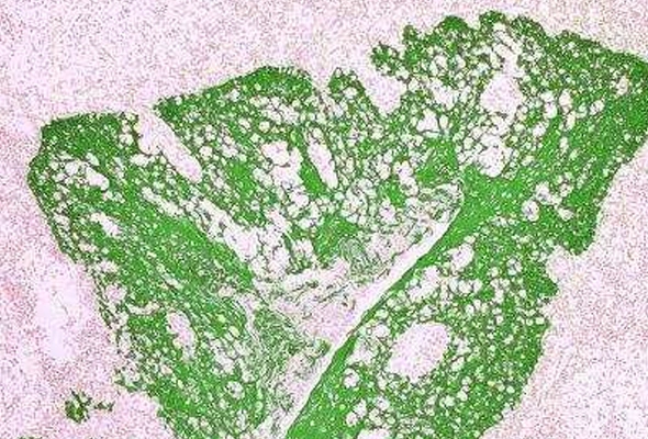 [Novus] Tissue Glue Kit 이미지
