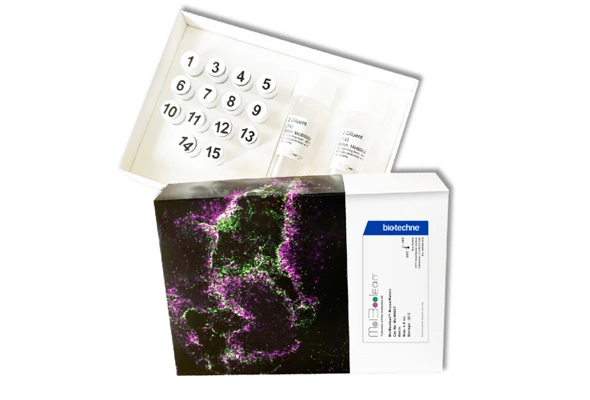 [Novus] MolBoolean Mouse/Rabbit Assay Kit 이미지