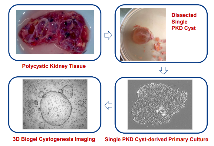 TCM-PKD